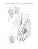 PACKAGED SEMICONDUCTOR CHIPS WITH ARRAY diagram and image