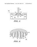 LOCALIZED ALLOYING FOR IMPROVED BOND RELIABILITY diagram and image