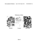 DIAGNOSIS AND TREATMENT OF TUMORS diagram and image