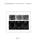 DIAGNOSIS AND TREATMENT OF TUMORS diagram and image