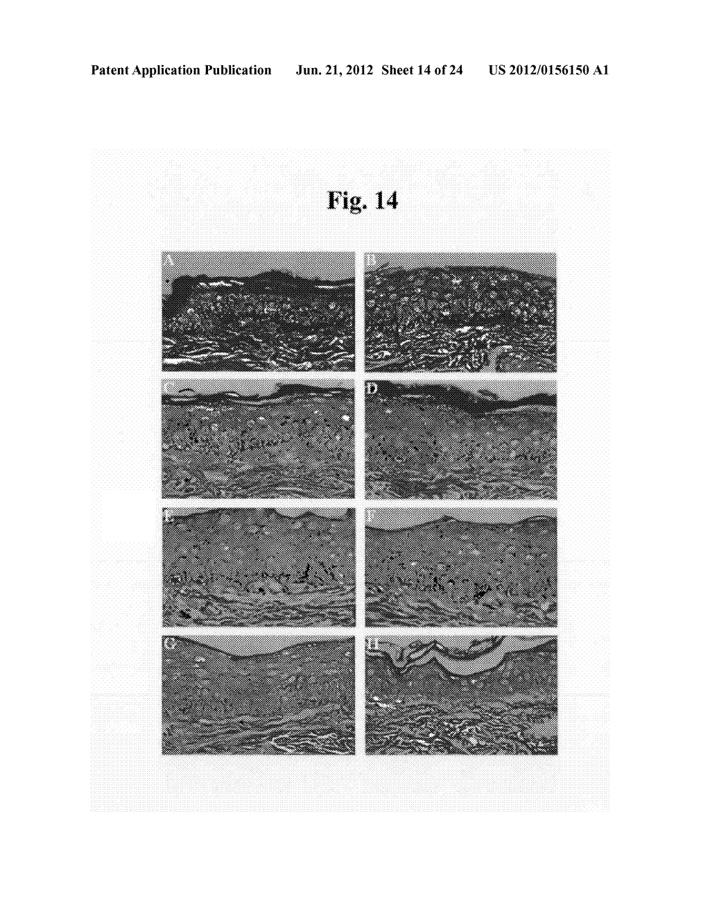 Composition for Improving Skin Condition Comprising Extract from Black Tea     as Active Ingredient - diagram, schematic, and image 15