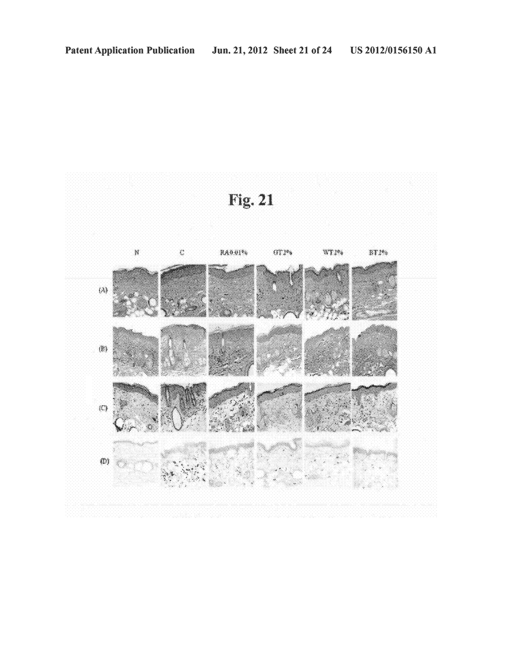 Composition for Improving Skin Condition Comprising Extract from Black Tea     as Active Ingredient - diagram, schematic, and image 22