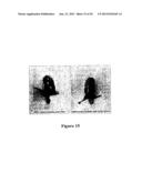 RECOMBINANT MYCOBACTERIUM STRAIN EXPRESSING A MYCOBACTERIAL FAP PROTEIN     UNDER THE CONTROL OF A PROMOTER ACTIVE UNDER HYPOXIA  AND ITS APPLICATION     FOR CANCER THERAPY diagram and image