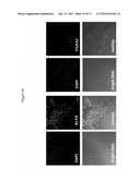 REPROGRAMMING CANCER CELLS diagram and image