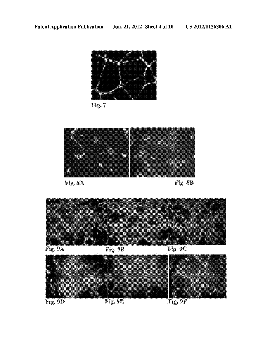 VIRAL INACTIVATED PLATELET EXTRACT, USE AND PREPARATION THEREOF - diagram, schematic, and image 05