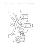 Hot-Runner System Including Melt-Flow Control Structure Integrally Formed     with the Manifold Body diagram and image