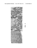 COMPOSITION FOR DIAGNOSIS OF LIVER METASTASIS OF COLORECTAL CANCER AND THE     USE THEREOF diagram and image