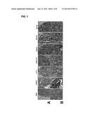 METHOD FOR DETERMINING THE RISK OF DEVELOPING BRAIN METASTASIS, AND A KIT     TO CARRY OUT SAID METHOD diagram and image