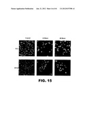 TARGETING EN2, PAX2, AND/OR DEFB1 FOR TREATMENT OF PROSTATE CONDITIONS diagram and image