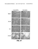 TARGETING EN2, PAX2, AND/OR DEFB1 FOR TREATMENT OF PROSTATE CONDITIONS diagram and image