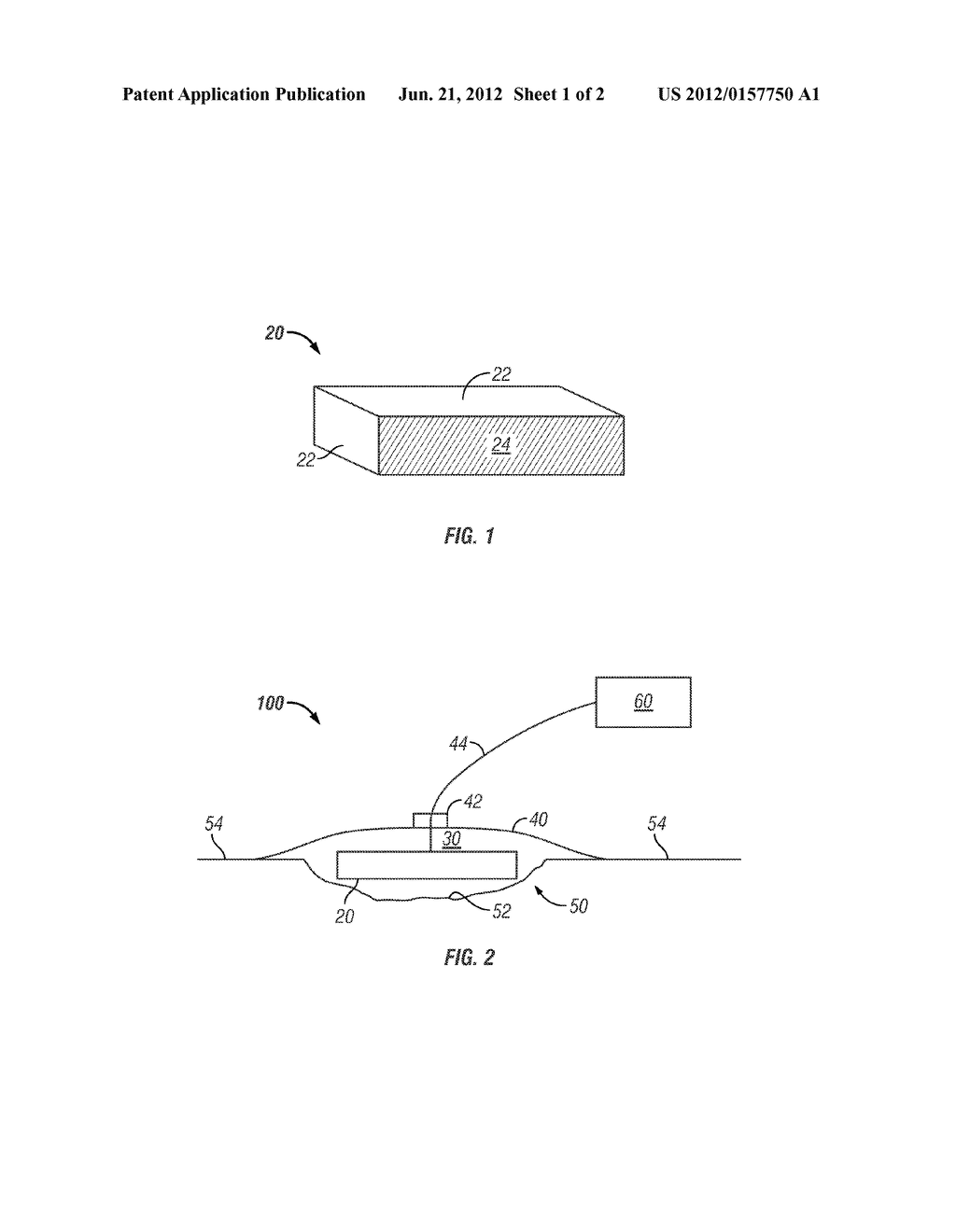 Targeted Delivery of Magnetically Tagged Active Agents in Combination with     Negative Pressure Wound Therapy - diagram, schematic, and image 02