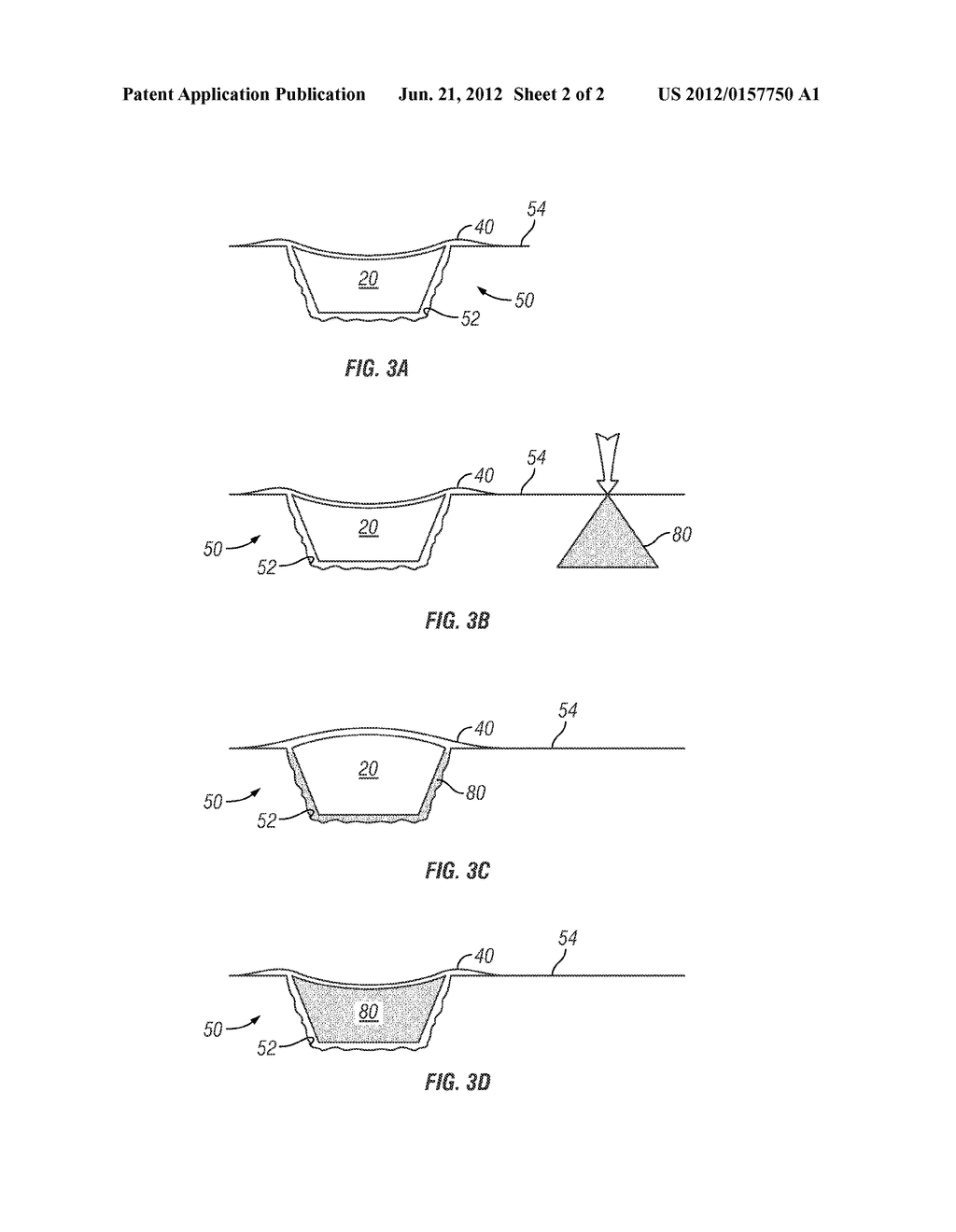 Targeted Delivery of Magnetically Tagged Active Agents in Combination with     Negative Pressure Wound Therapy - diagram, schematic, and image 03