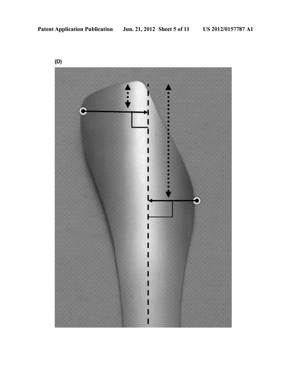 TOOLS FOR TRANSORAL SURGERY - diagram, schematic, and image 06