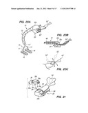 SURGICAL INSTRUMENTS, SYSTEMS AND METHODS OF USE diagram and image