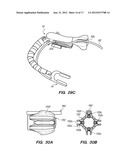 SURGICAL INSTRUMENTS, SYSTEMS AND METHODS OF USE diagram and image