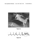 High-Speed, High-Resolution Electrophysiology In-Vivo Using Conformal     Electronics diagram and image