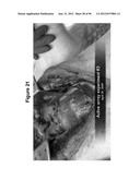 High-Speed, High-Resolution Electrophysiology In-Vivo Using Conformal     Electronics diagram and image