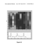 High-Speed, High-Resolution Electrophysiology In-Vivo Using Conformal     Electronics diagram and image