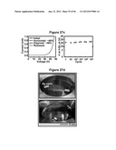 High-Speed, High-Resolution Electrophysiology In-Vivo Using Conformal     Electronics diagram and image