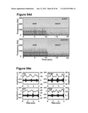 High-Speed, High-Resolution Electrophysiology In-Vivo Using Conformal     Electronics diagram and image