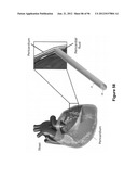 High-Speed, High-Resolution Electrophysiology In-Vivo Using Conformal     Electronics diagram and image