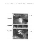 High-Speed, High-Resolution Electrophysiology In-Vivo Using Conformal     Electronics diagram and image