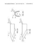 Evoked Stapedius Reflex Threshold (ESRT) Tile Electrode diagram and image