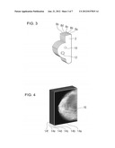 IMAGING METHOD AND IMAGING DEVICE FOR DISPLAYING DECOMPRESSED VIEWS OF A     TISSUE REGION diagram and image