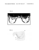 IMAGING METHOD AND IMAGING DEVICE FOR DISPLAYING DECOMPRESSED VIEWS OF A     TISSUE REGION diagram and image