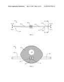 ANCHOR INSTRUMENTATION AND METHODS diagram and image