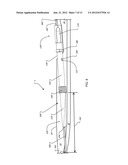 ANCHOR INSTRUMENTATION AND METHODS diagram and image