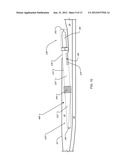 ANCHOR INSTRUMENTATION AND METHODS diagram and image