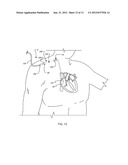 ANCHOR INSTRUMENTATION AND METHODS diagram and image