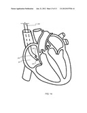 ANCHOR INSTRUMENTATION AND METHODS diagram and image