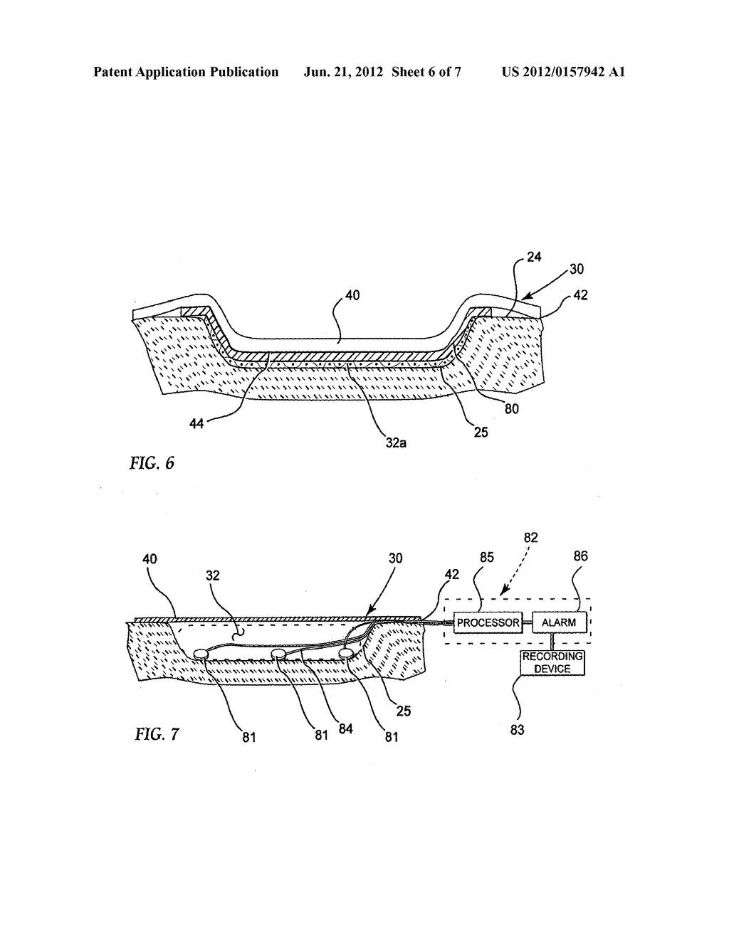 REDUCED PRESSURE TREATMENT SYSTEM - diagram, schematic, and image 07