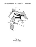 ENHANCED SYSTEMS, PROCESSES AND APPARATUS FOR FACILITATING INTRANASAL     TREATMENT OF A PATIENT AND PRODUCTS THEREBY diagram and image