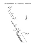 CATHETER DEVICE diagram and image