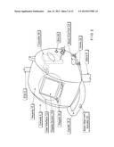 Thermal Ablation System diagram and image