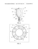 GLOBAL ENDOMETRIAL ABLATION DEVICE diagram and image