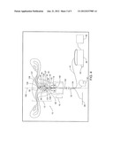 GLOBAL ENDOMETRIAL ABLATION DEVICE diagram and image