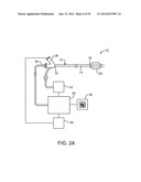 Selectable Eccentric Remodeling and/or Ablation of Atherosclerotic     Material diagram and image