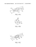 TUNED RF ENERGY FOR SELECTIVE TREATMENT OF ATHEROMA AND OTHER TARGET     TISSUES AND/OR STRUCTURES diagram and image