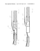 Endoscopic Suture Cinch System diagram and image