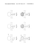 Expandable Implant and Implant System diagram and image