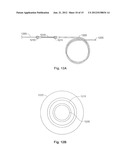 Expandable Implant and Implant System diagram and image