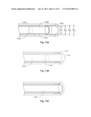 Expandable Implant and Implant System diagram and image