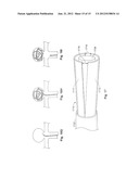 Expandable Implant and Implant System diagram and image