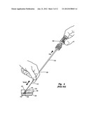 VASCULAR CLOSURE DEVICE WITH AUTOMATIC SUTURE CUTTER diagram and image