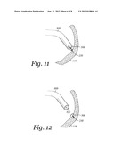 APPARATUS AND METHOD FOR DRIVING A HEMORRHAGE OCCLUDER PIN INTO A HUMAN     SACRUM diagram and image