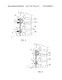 VERTEBRAL OSTEOSYNTHESIS EQUIPMENT diagram and image